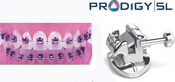 Брекеты Prodigy Брекеты Prodigy
