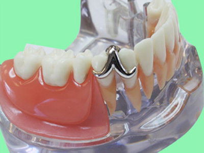зубной протез