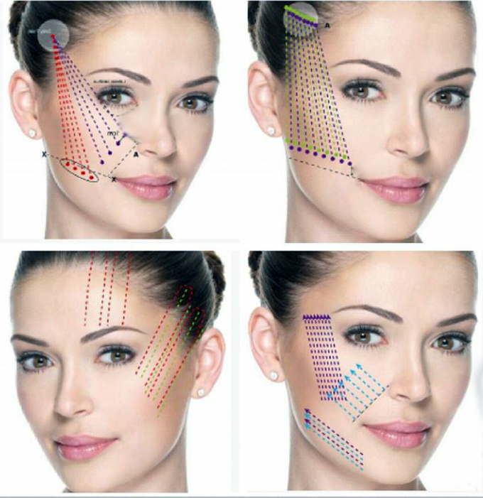 3D-мезонити 3D-мезонити